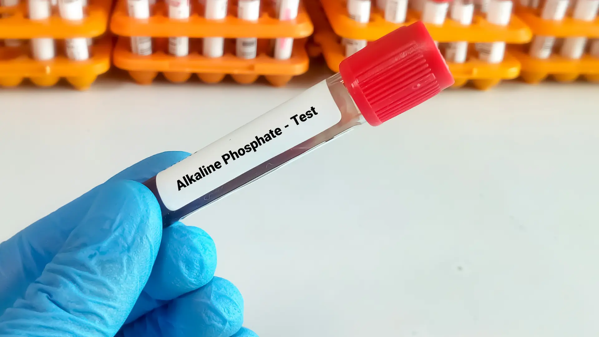 Alkaline Phosphatase